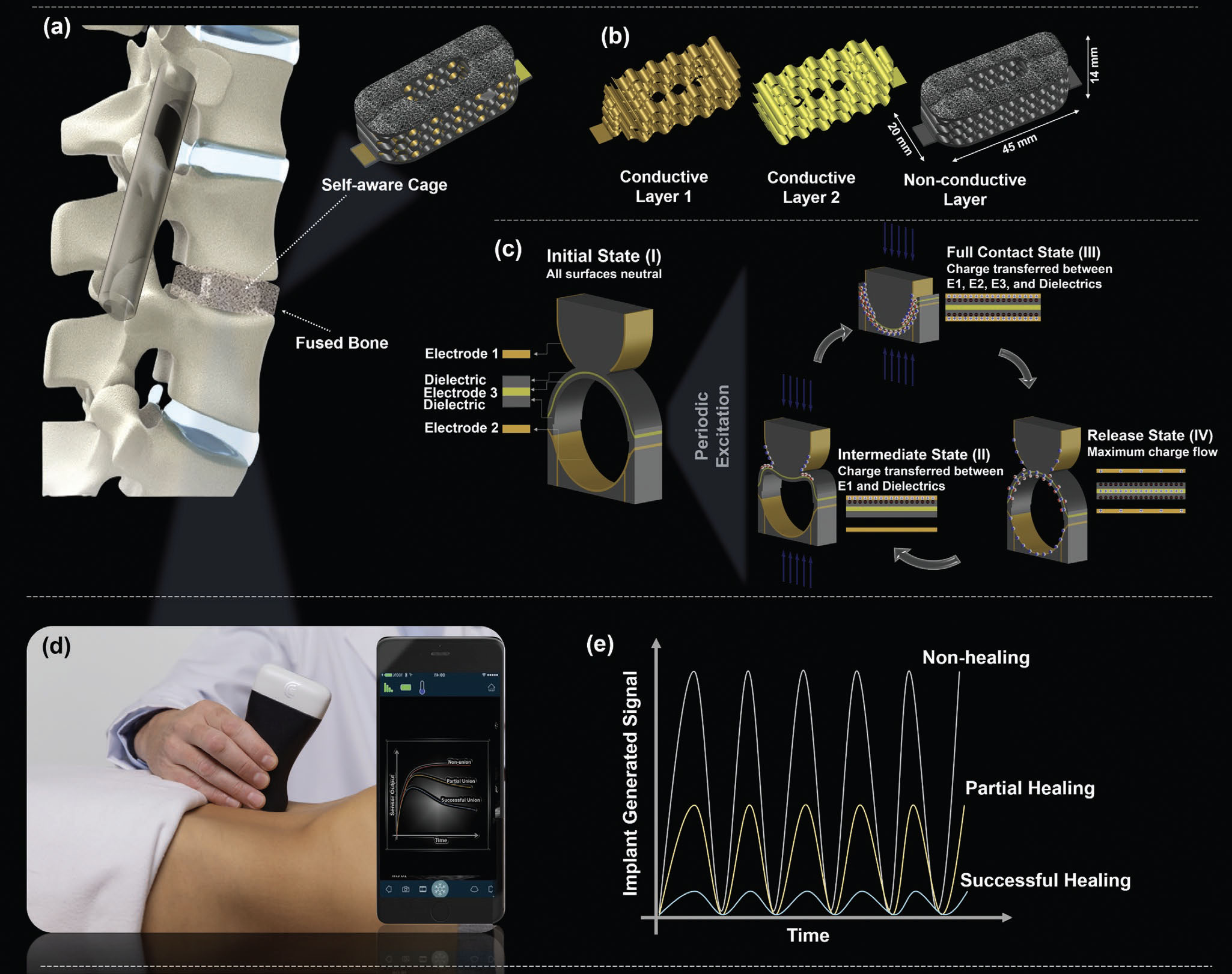 'Self-aware' and self-powered metamaterial implants