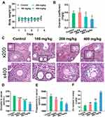 Zinc Oxide Particles Can Cause Ovarian Toxicity by Oxidative Stress in Female Mice Model