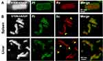 Biodistribution and Toxicological Effects of Ultra-Small Pt Nanoparticles Deposited on Au Nanorods (Au@Pt NRs) in Mice with Intravenous Injection