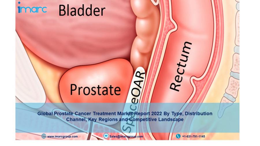 Prostate Cancer Treatment Market Size 2022 | Share, Growth, Global Analysis Report 2027