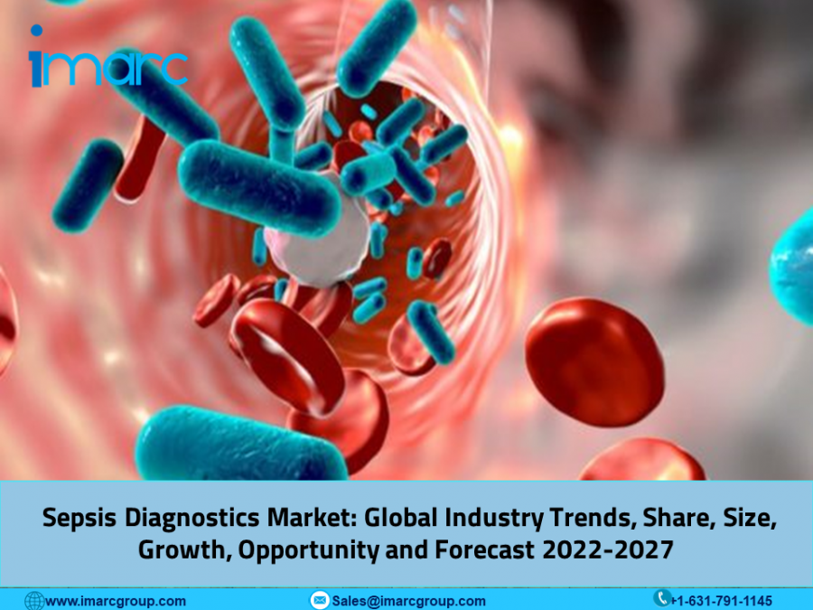 Sepsis Diagnostics Market Size, Leading Companies Share, Growth and Research Report 2022-2027