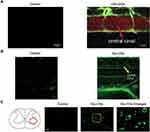 Applications of Carbon Dots for the Treatment of Alzheimer’s Disease