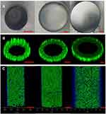 Experimental Investigation of Temperature Influence on Nanoparticle Adhesion in an Artificial Blood Vessel