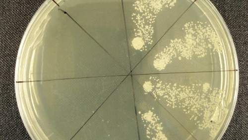 Image showing thedifference between microbes (golden Staph) incubated with the treatment with and without light activation. The left-hand side showing complete eradication of bacterial colonies