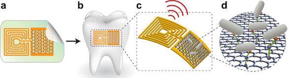 tooth tattoo sensor