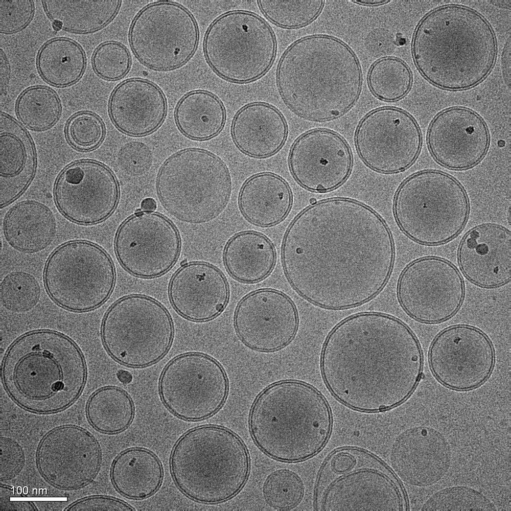 New nanotransporter delivers drugs inside cells