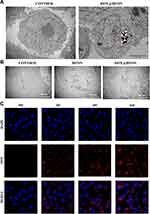 An Magnetic-Targeting Nano-Diagnosis and Treatment Platform for TNBC