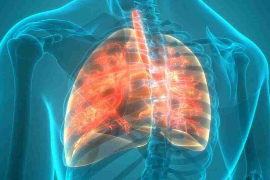 Cystic Fibrosis Market Research Report 2022-2032: Size, Share, Top Key Players, and Forecast