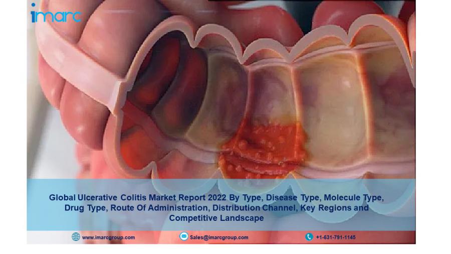 Ulcerative Colitis Market Size, Share Report, 2022-27: Growth, Top Companies, Statistics, Regional Analysis And Forecast