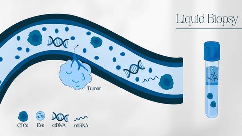 Liquid Biopsy Test: Protocol and Steps