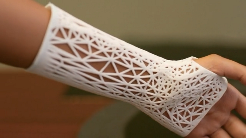 A 3D printed arm cast by PrinterPrezz. Image via PrinterPrezz