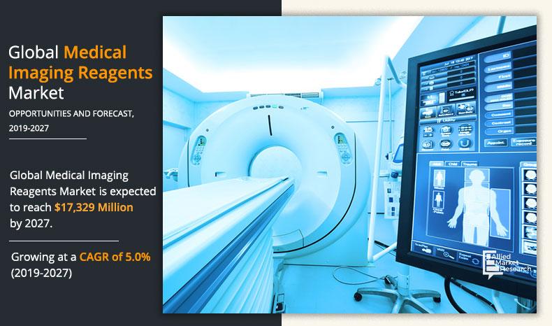 Medical Imaging Reagents Market  Size is Likely to Reach a Valuation of Around $17.32 Billion by 2027