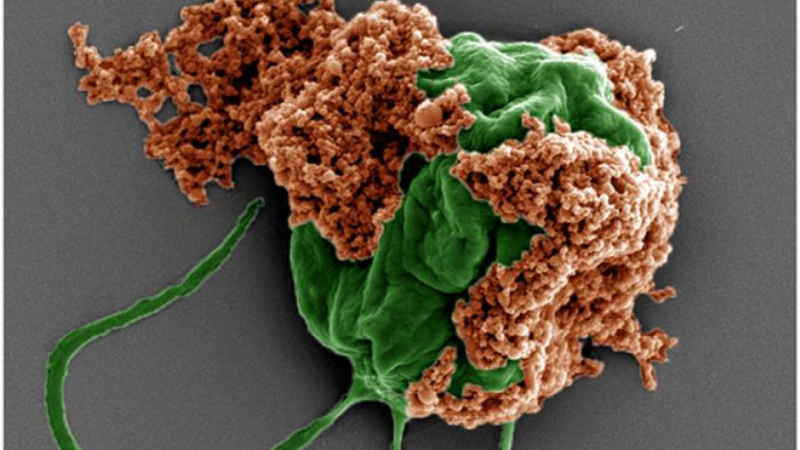 Microrobots deliver cancer medication to metastatic tumours