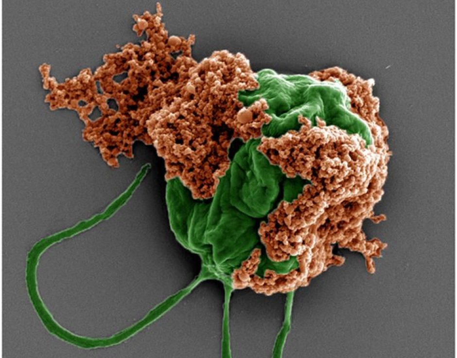 Microrobots deliver cancer medication to metastatic tumours