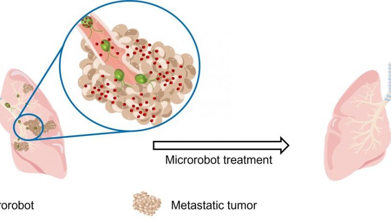 Algae-Based Microbots Deliver Cancer Drugs Directly to Lung Tumors