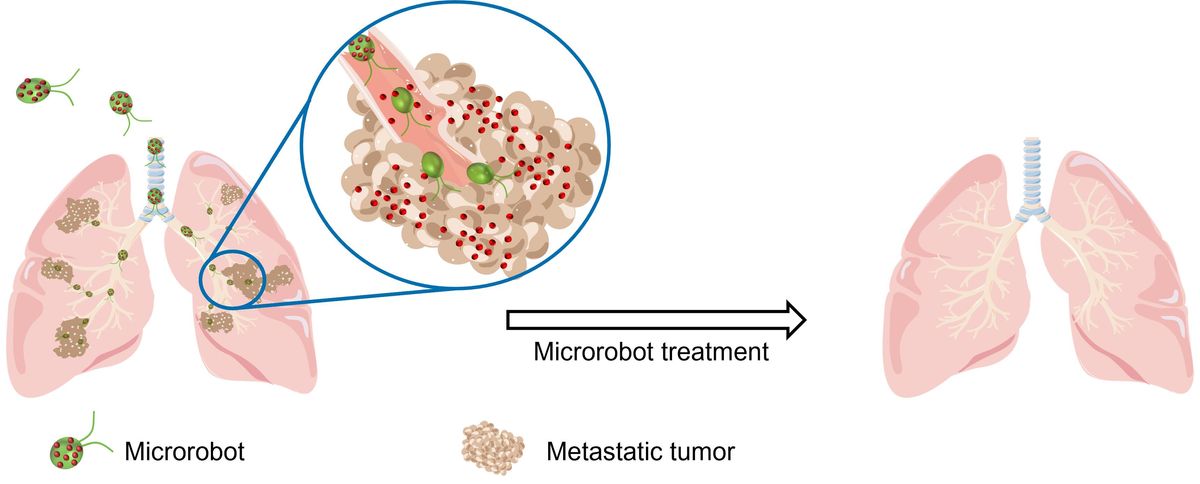 Algae-Based Microbots Deliver Cancer Drugs Directly to Lung Tumors