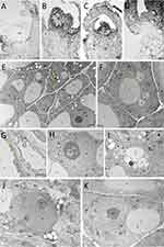 Nanoparticles in Plant Cryopreservation: Effects on Genetic Stability, Metabolic Profiles, and Structural Integrity in Bleeding Heart (Papaveraceae) Cultivars