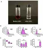 Three images showing blueberry juice before and after SEC, NTA size distribution profiles and comparison of isolation methods.